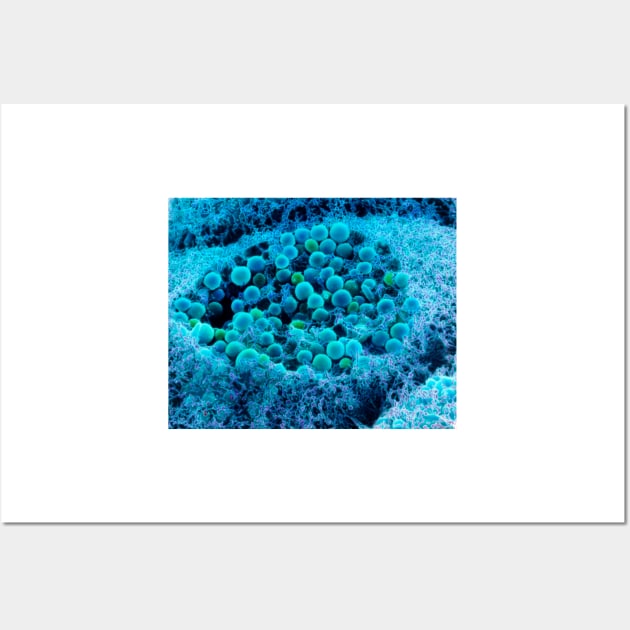 Col. SEM of eye melanocyte cell & pigment granules (P424/0108) Wall Art by SciencePhoto